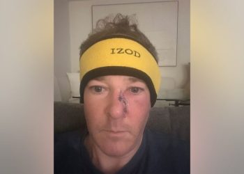 EPA administrator Lee Zeldin reveals he underwent surgery to remove skin cancer from his face